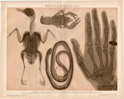 Röntgen, röntgensugár, színes nyomat 1895, német, litográfia, eredeti, gyógyászat, csont, madár, kéz