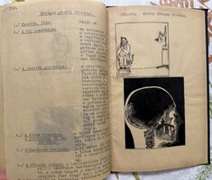 Kézzel rajzolt fogászati röntgen technika 1954