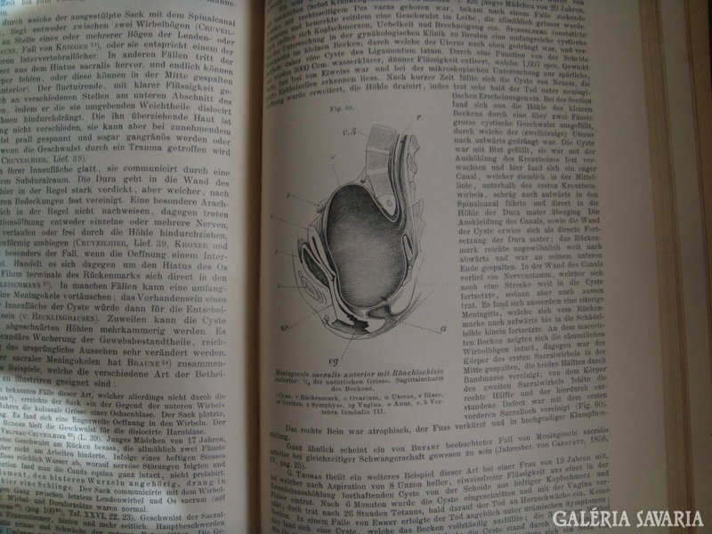 1899-ből NÉMET SEBÉSZETI KÖNYV, orvosi könyv 19. század