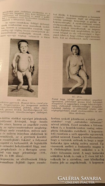Dr. Jenő Kopits-dr. Imre Kopits: textbook of orthopaedics