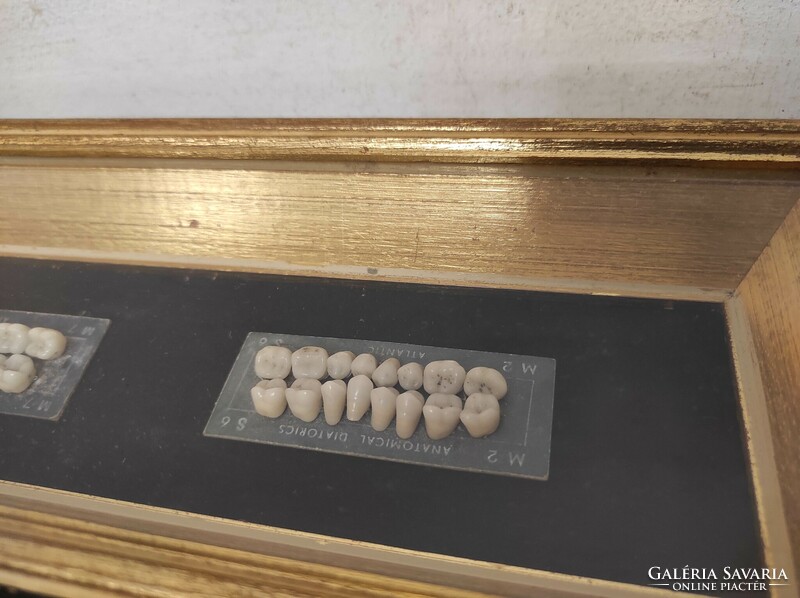 Antik fogorvos doktor orvosi fogtechnikus fog készlet szerszám fa dobozában 189