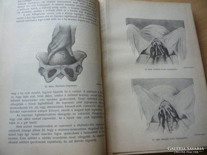 Szülészeti műtéttan. Sztehlo.
