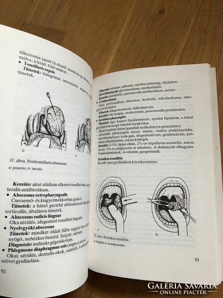 Ribari-fabinyi: otolaryngology