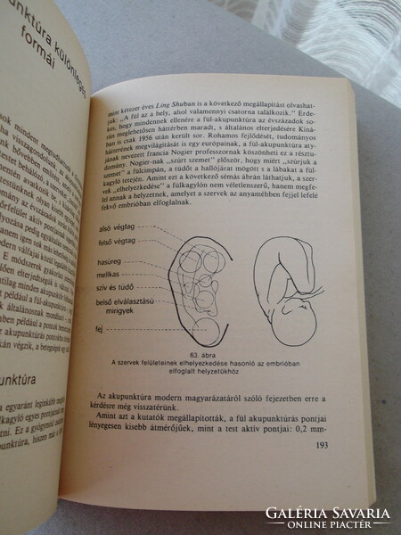 Chinese acupuncture in the past and today. Book for sale! 1988, Dr. Péter Simoncsics