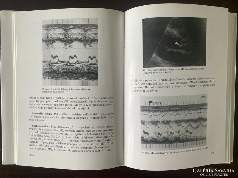 László Mihóczy: non-invasive cardiology examination methods