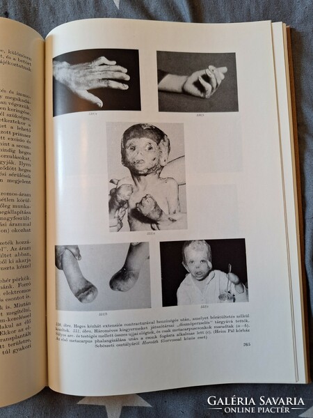 1961-Medicine-dr. Rudolf Kós: surgery of the hand - new!