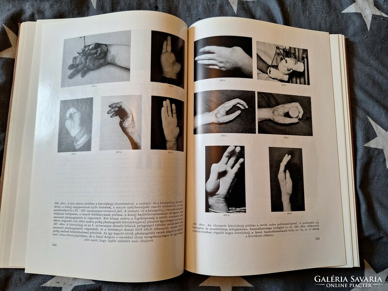 1961-Medicine-dr. Rudolf Kós: surgery of the hand - new!