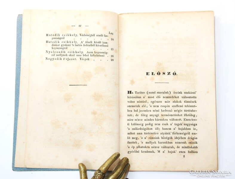 1842 - Dr. Virányi Kálmán - Nincs többé kopasz fej! A haj-bajok gyógyítása Ritka orvosi könyv !!